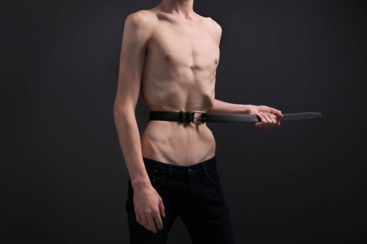 Um homem desnutrido com anorexia
