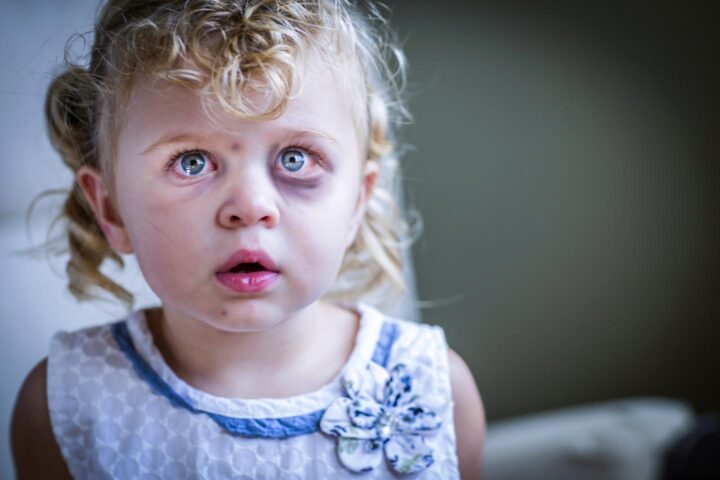 Uma menina sendo vítima de abuso físico