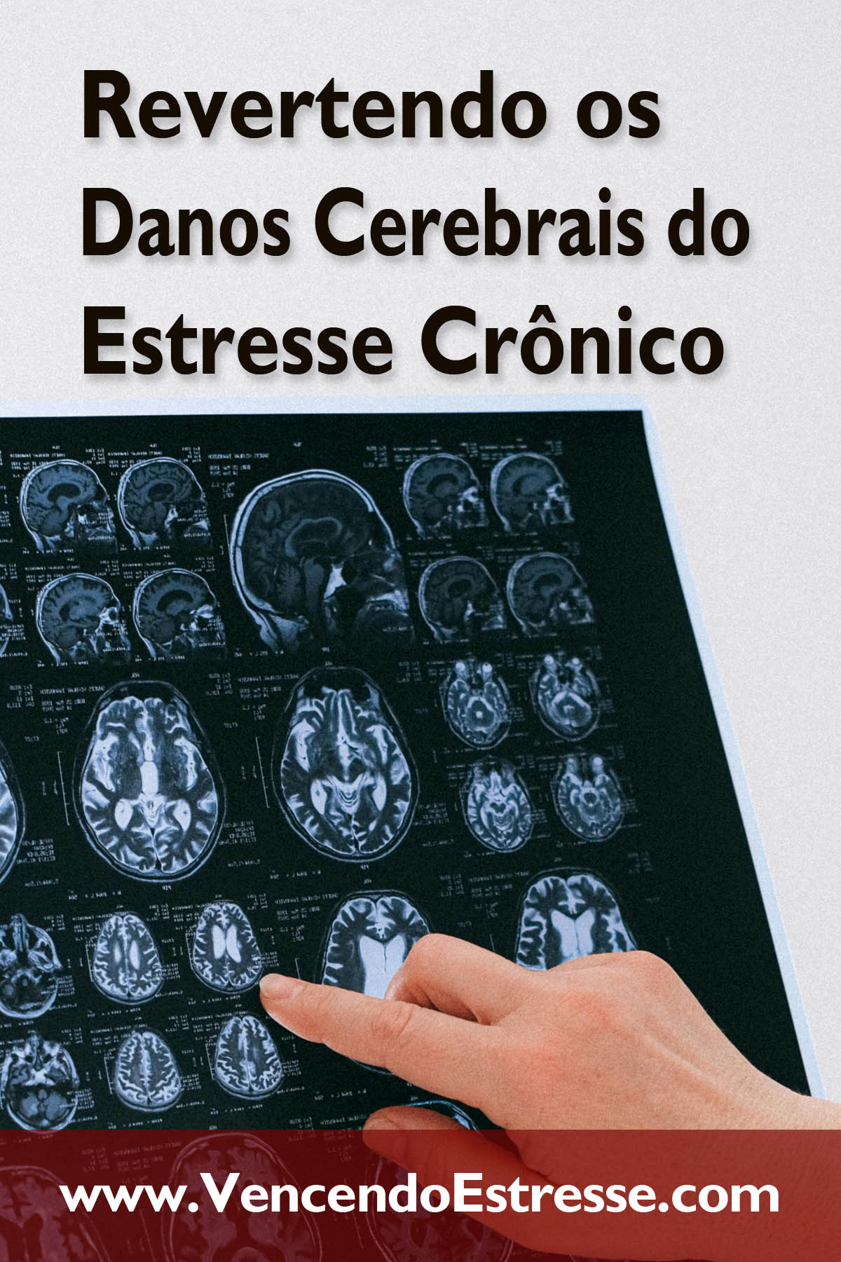 Revertendo os Danos Cerebrais do Estresse Crônico